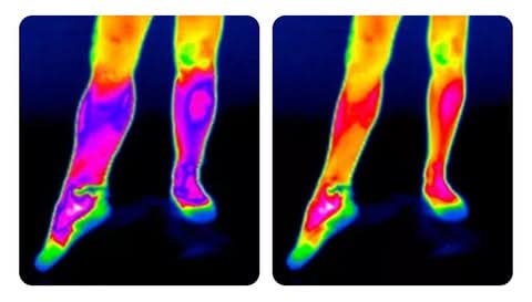 Self-heating knee brace: quick relief from pain 