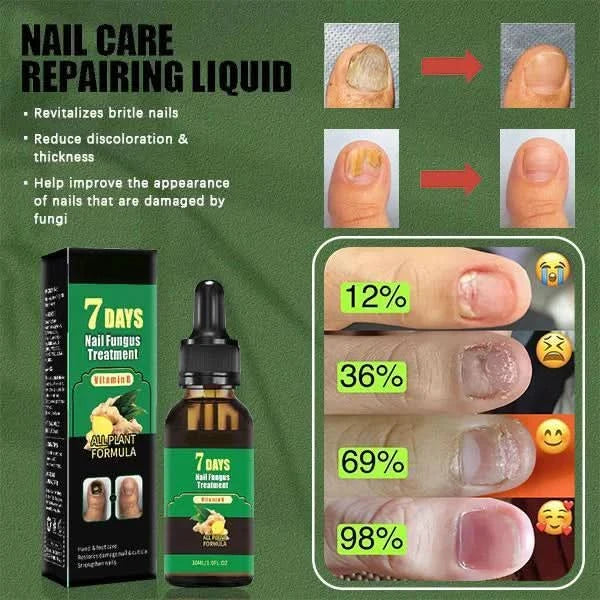 Nagelbehandlung – Natürliche Antipilzbehandlung 