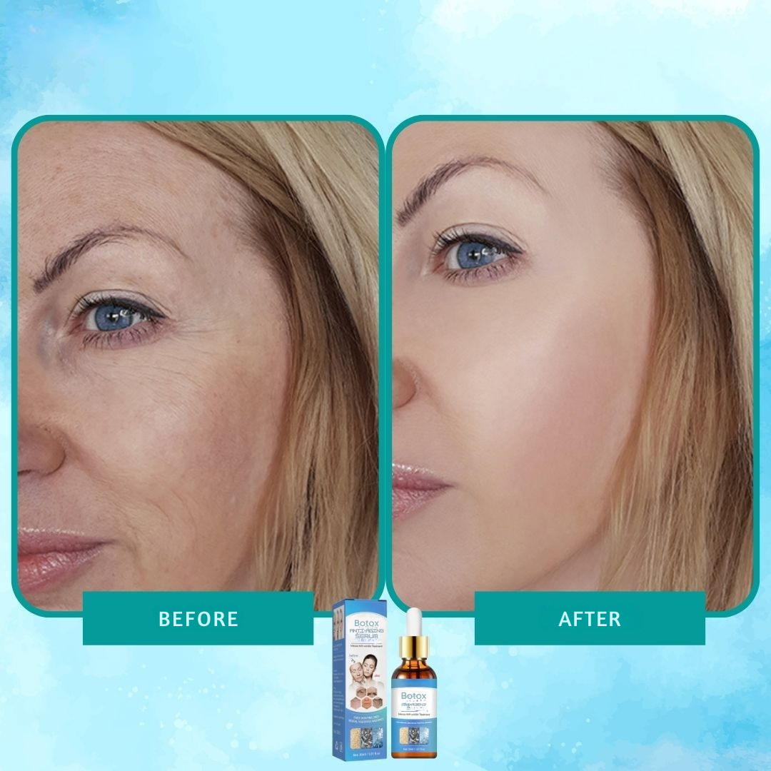 Intensiv anti-rynke botox serum elixir 
