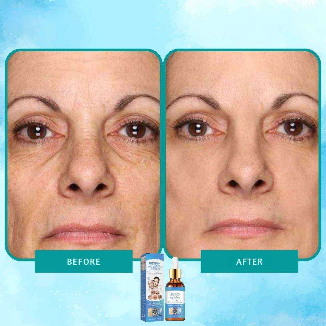 Intensiv anti-rynke botox serum elixir 
