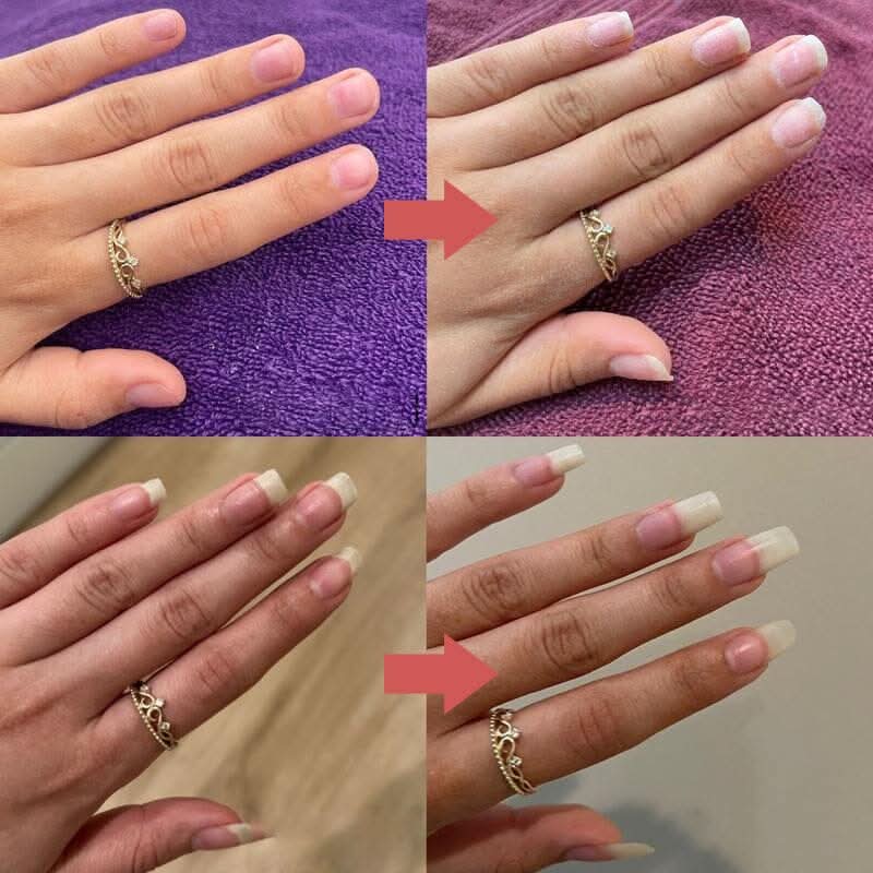 Nourishing pen for cuticles and dry nails 