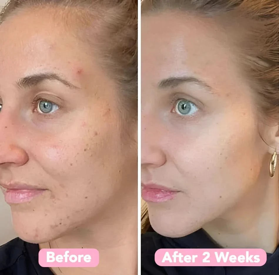 Esponja de cúrcuma – Piel limpia y purificada naturalmente (x40) 
